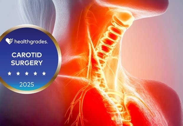 Healthgrades badge over image of highlighted carotid arteries